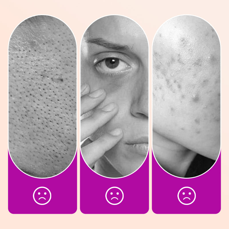 🔥Buy 2 Get 1 Free🔥Flawless Brightening Under Eye Concealer